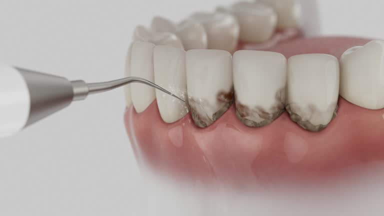 Reliable Dental Implants contractor in Frisco, TX by Smile Center Dentistry